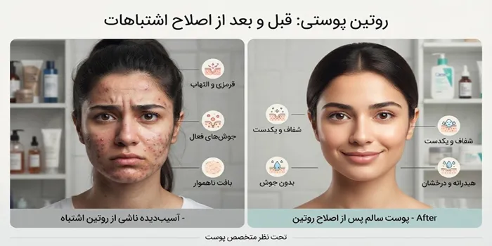 روتین پوستی صحیح 5456421