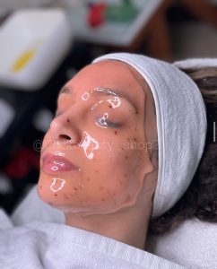 ماسک هیدروژلی