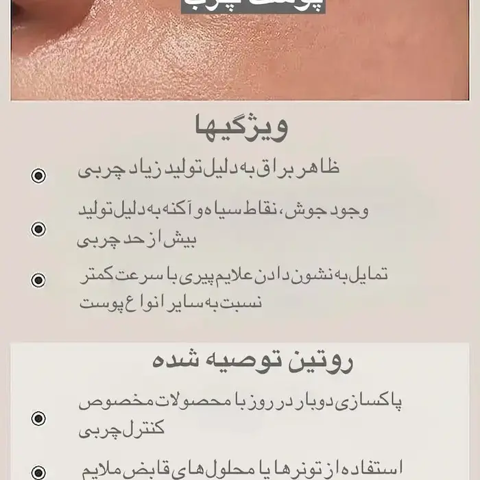 روتین پوستی برای پوست چرب 56165310