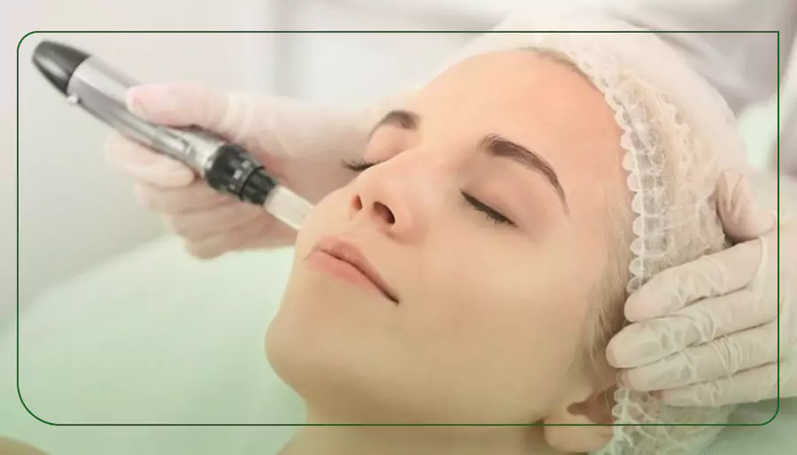 مراحل انجام پلاژن