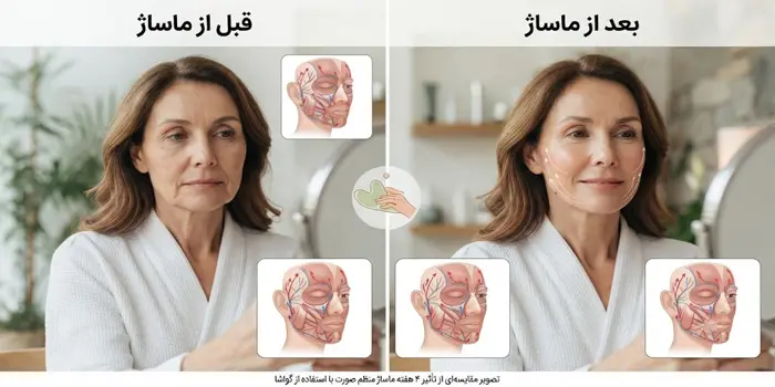 جوانسازی و لیفت صورت برای گردش خون در صورت 524524
