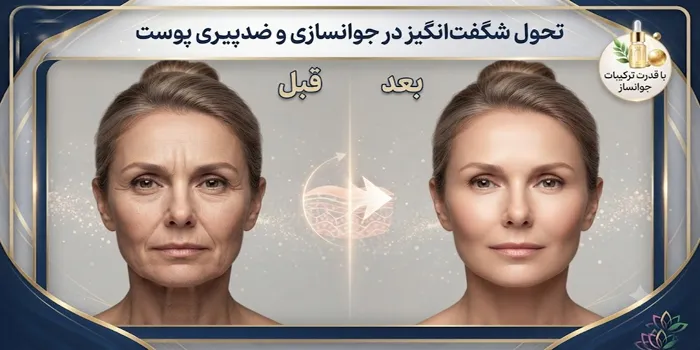 قبل و بعد لیفت صورت بدون جراحی 65435634