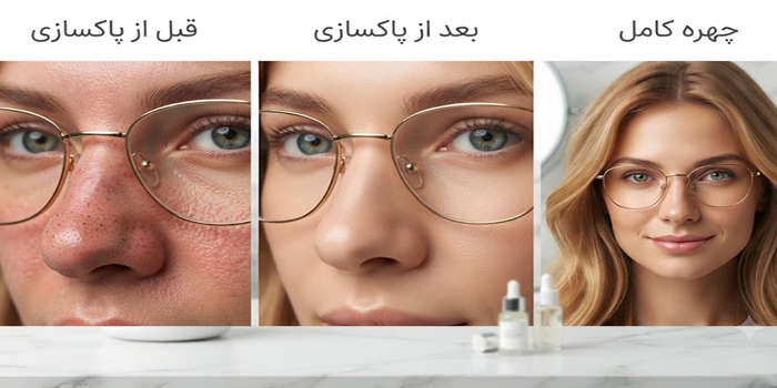 مراحل پاکسازی بینی 541521