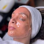 ماسک هیدروژلی