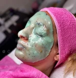 ماسك هیدروژلی کیوی دکتر مینایر