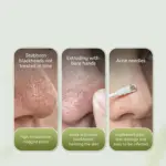 چسب بینی کاسه‌ ای لانبنا 65415210