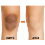 کرم کاسه ای سفید کننده زانو و آرنج مویام 120 گرم 65456312