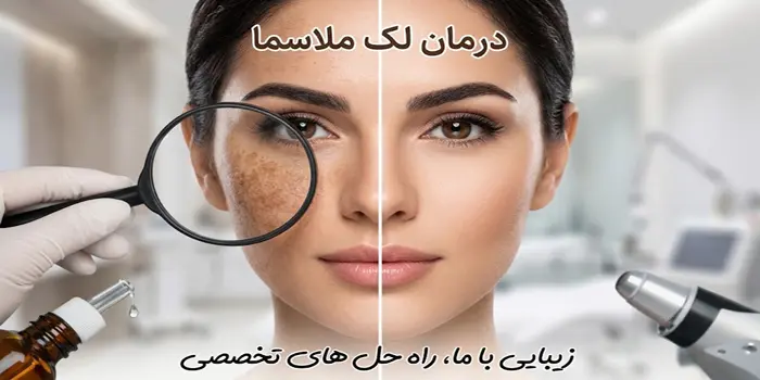قبل و بعد از درمان ملاسما 654564312
