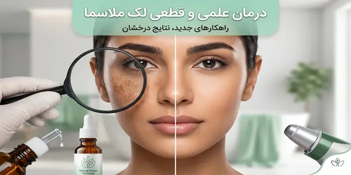جلوگیری از رشد ملاسما با روتین پوستی مناسب 685464312